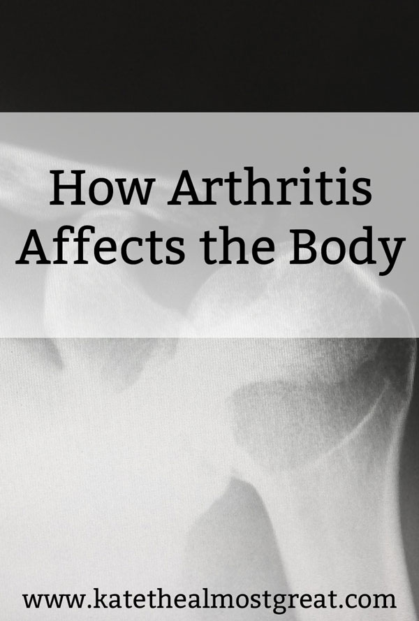 How Arthritis Affects the Body | Kate the (Almost) Great, Boston Blogger